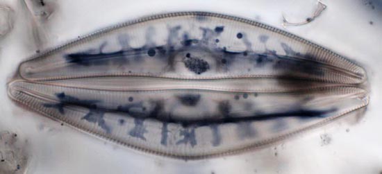 Cymbella lanceolata zygotene, nucleolus visible